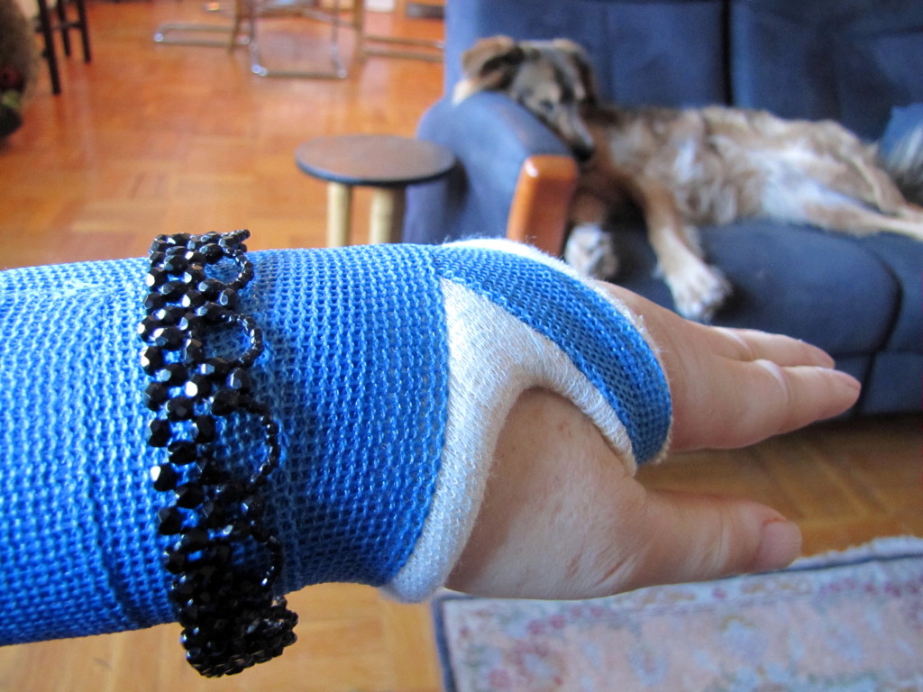 My bejewelled wrist cast in January